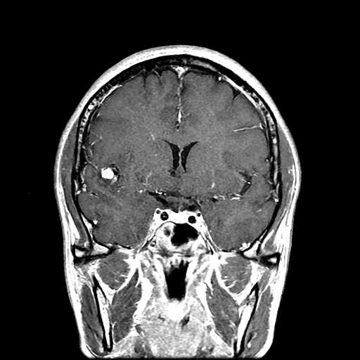 800620M9  MRI2.jpg