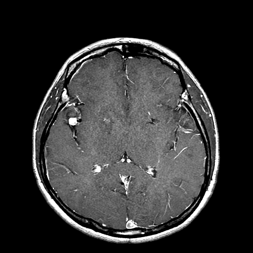 800620M9  MRI4.jpg