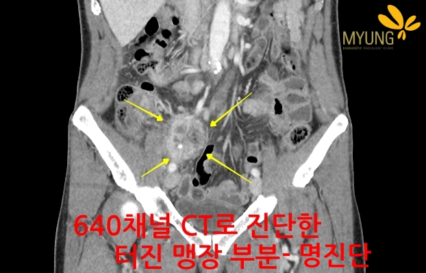 144999 CT0sss.jpg