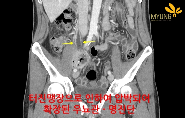 144999 CT4sss.jpg