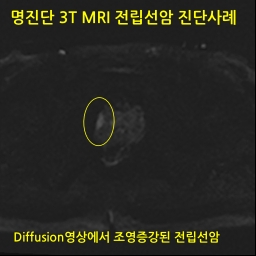 228525 PES1cr.jpg
